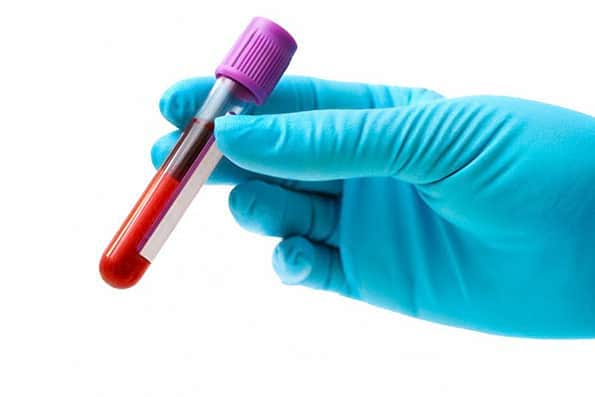شناسایی صدها پروتئین در نمونه خون با فناوری جدید